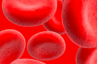 anemia sideropenica